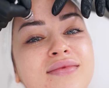 Thumbnail for Discounted Facials and Skin Treatments at OVME! 